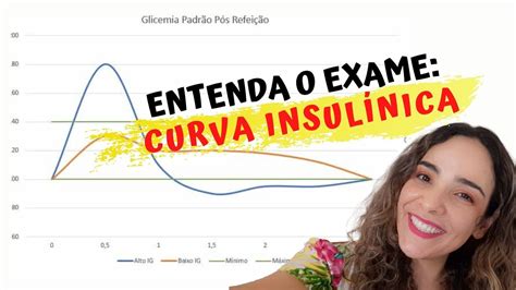 exame curva glicemica - eeg exame